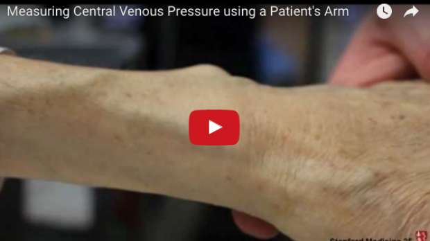 Measuring Central Venous Pressure with the Arm