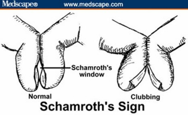 clubbing.Schamroths-Sign-1