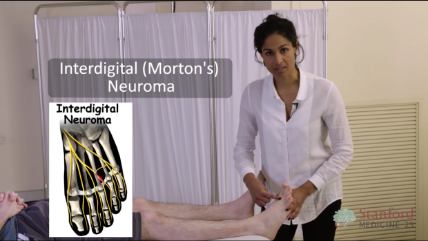 Interdigital (Morton’s) Neuroma