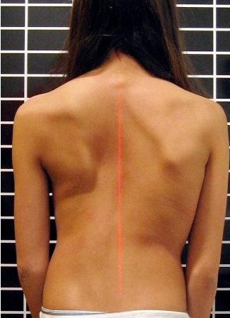 325px x 448px - Low Back Exam, Approach to | Stanford Medicine 25 | Stanford Medicine