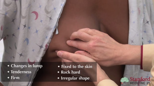 Palpation: critical features of a mass