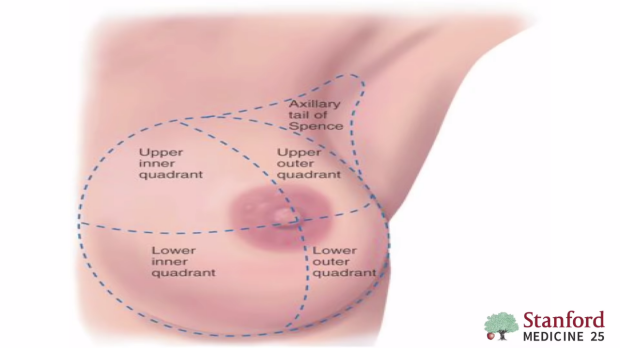 Breast quadrants
