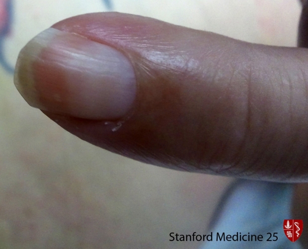 The Hand Examination | Stanford Medicine 25 | Stanford Medicine