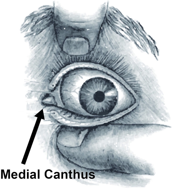 medial canthus of eye